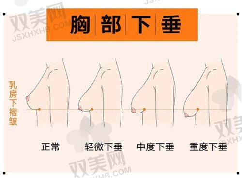 2025 年东莞隆鼻医院排名情况