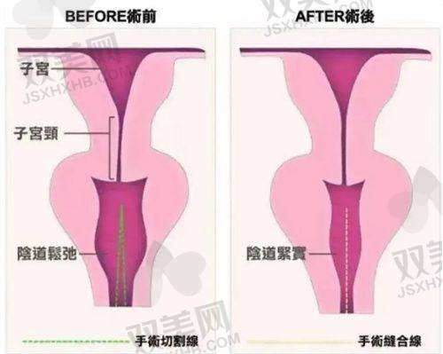 苏州维多利亚整形医院的综合情况