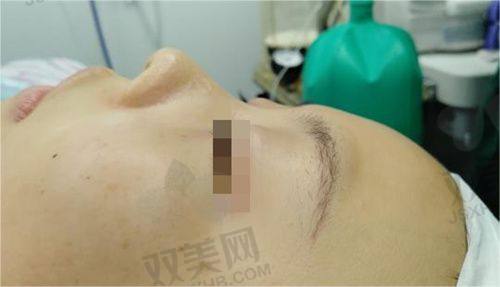 全文总结