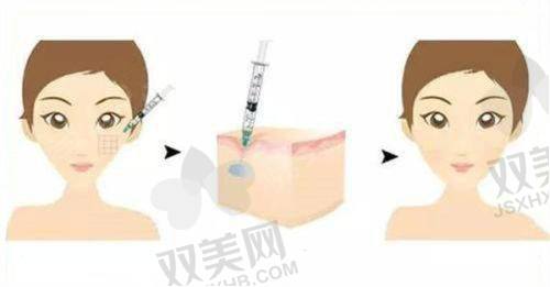 全文总结