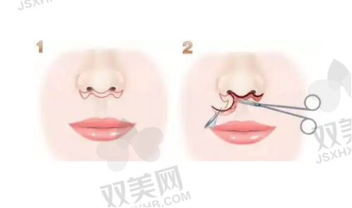 如何选择正规的尖峰之星超声王仪器项目机构