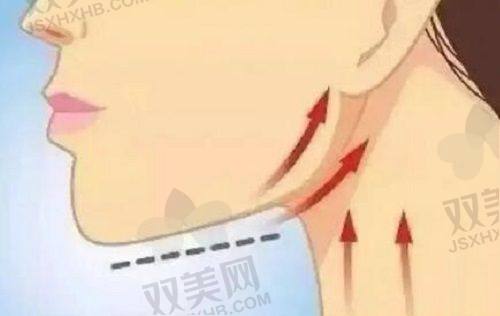 常见的成效表现