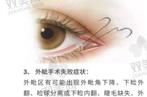 宜昌伊莱美医疗美容医院价格表，3D隆鼻16933元起，进口假体隆胸28000元超值