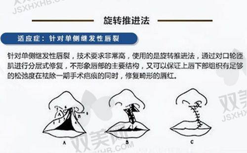 费用的构成因素