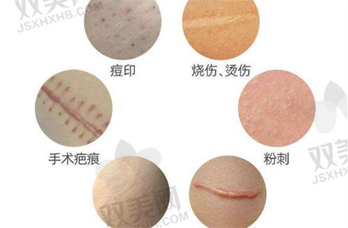 日常护理小妙招去除抬头纹
