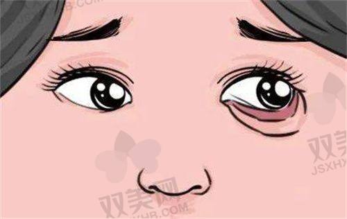 面部填充的未来趋势