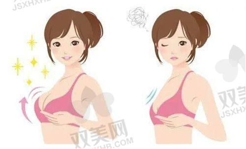 法令纹填充后消肿时间要多久