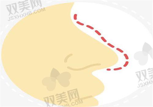 尖峰之星超声王仪器项目的未来发展趋势