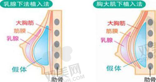 操作过程是否疼痛？