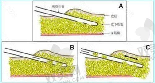 全文总结