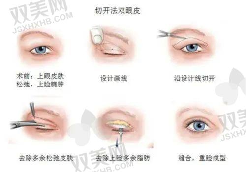 是否有副作用？