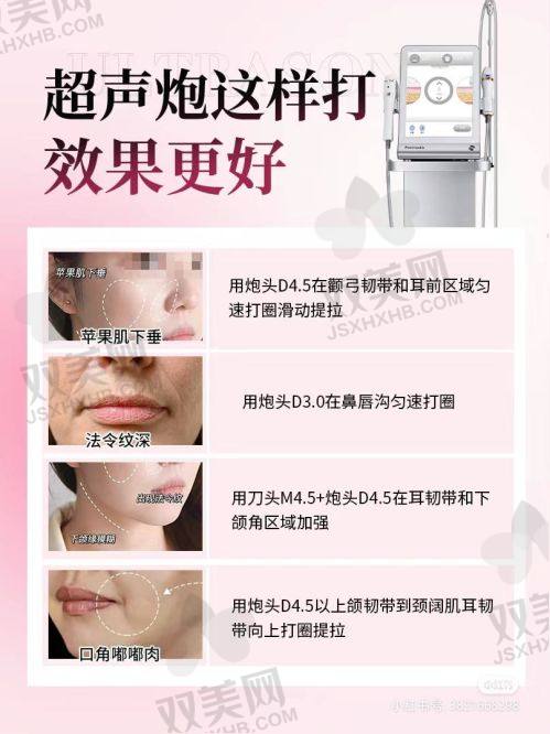 总结与关键提示