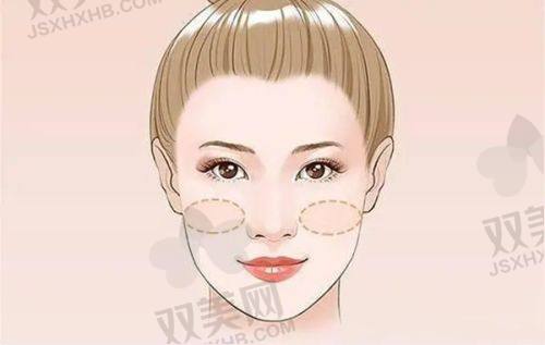 如何选择合适的填充方式和医院医生