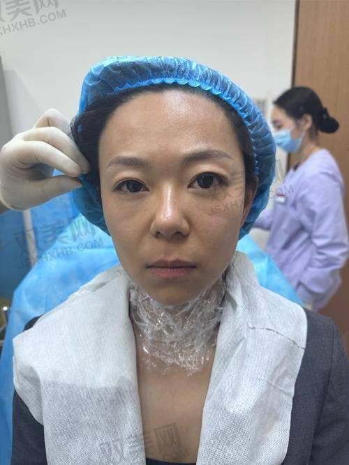 单独注射丽珠兰黑盒的成效