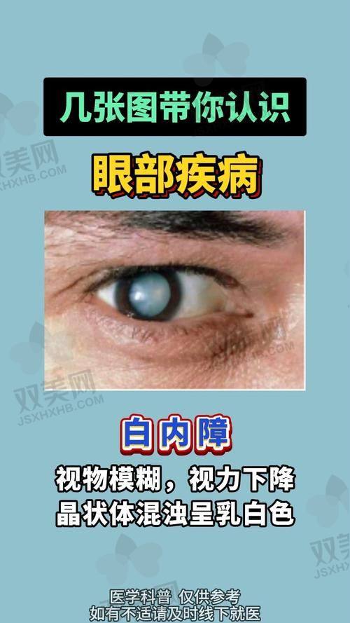 四、白内障·青光眼·其他眼科项目价格明细