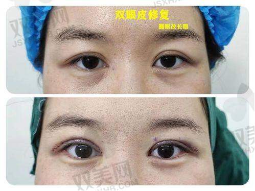 【荆州汇美医疗美容诊所技术特点】