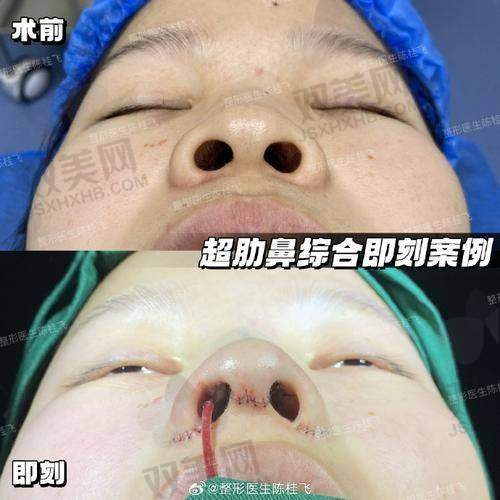 【荆州华美医疗美容医院是私立还是公办】
