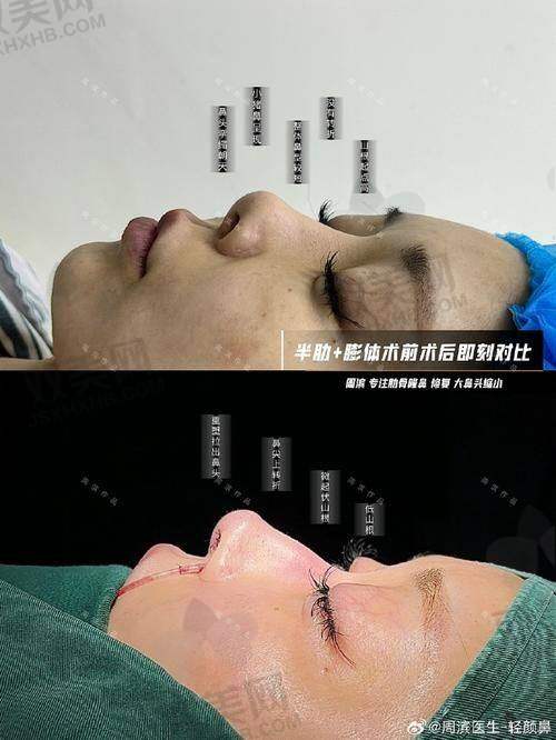 【荆州华美医疗美容医院地址及乘车路线】