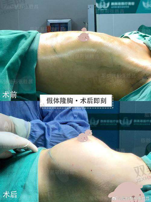 【咸宁辰星医疗美容医院技术特点】