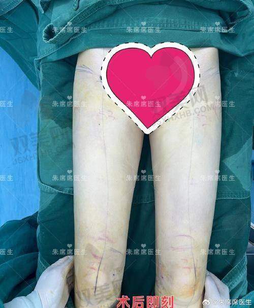 【荆州华美医疗美容医院技术特点】