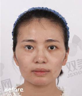 【荆州华美医疗美容医院怎么预约挂号】