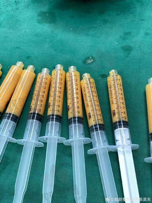 【荆州华美医疗美容医院是正规的吗】