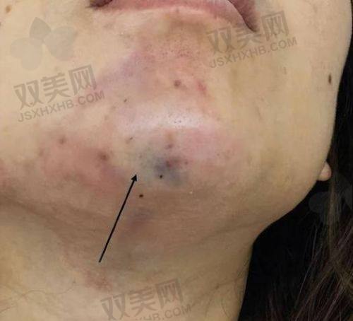 【襄阳禾丽白月光医疗美容医院营业时间是什么时候】