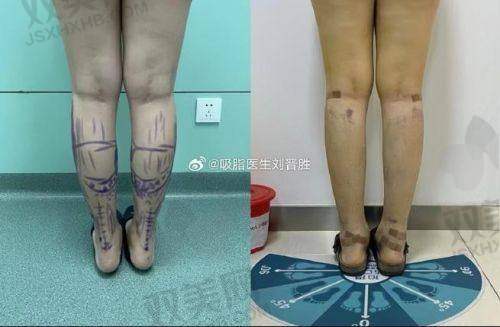 写在末尾：如生天使不是魔法棒，但一定是“骨相雕刻师” ?️