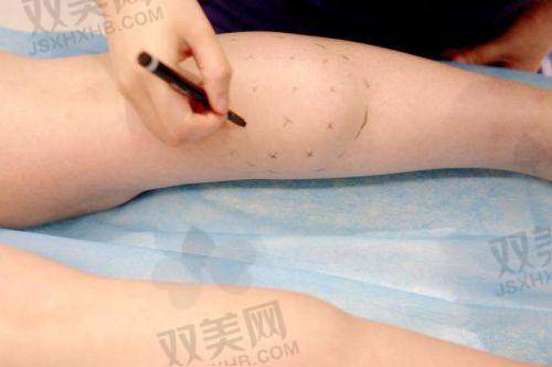 如生天使打几次？打几处？关键看你要“修哪里”！?