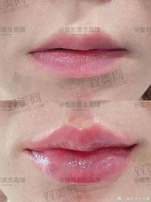 考虑年龄因素