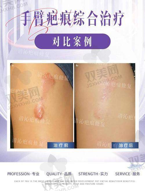 上海江城皮肤医院收费到底贵不贵