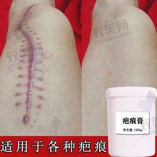 上海江城皮肤医院收费贵不贵？不贵直接来看价格表