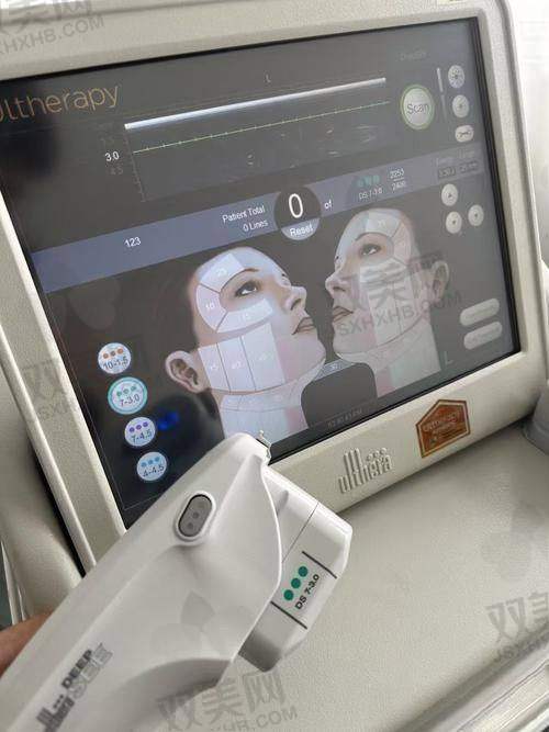 超声炮的功效有哪些