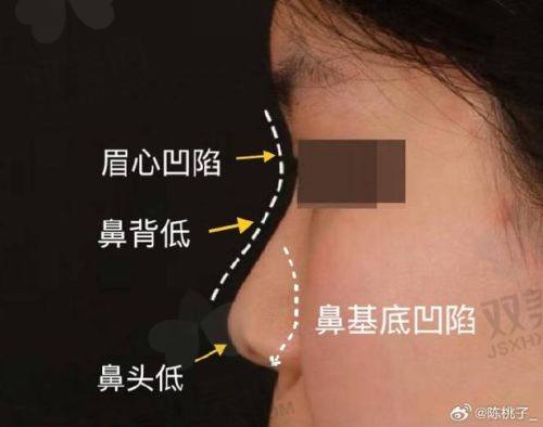 【荆州市美熙禾美医疗美容诊所擅长什么项目】
