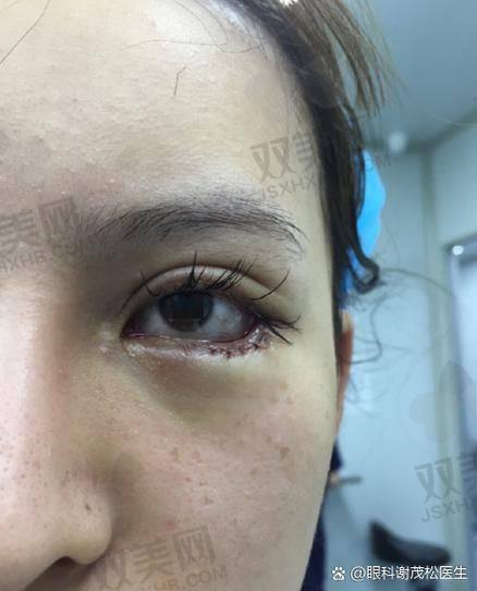 【荆州汇美医疗美容诊所是正规的吗】