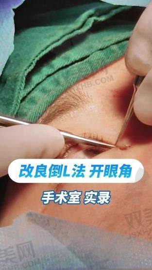 【荆州汇美医疗美容诊所擅长什么项目】