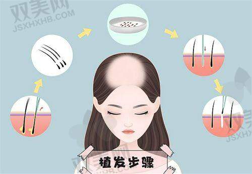 【西安科大植发医院擅长什么项目】