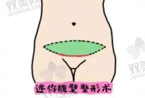 耳再造价格详情及医生优势