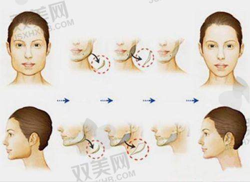 上海联合丽格整形的全方面总结