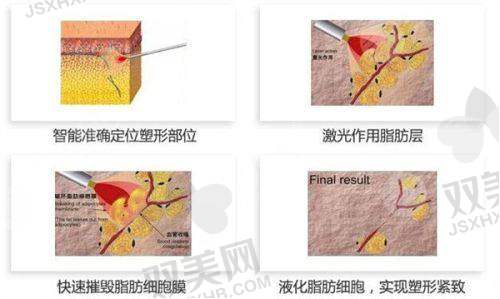 湛江韩逅医疗美容门诊部新的价格表，毛发移植15元起，隆鼻15000元起！