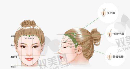 【西安科大植发医院地址】