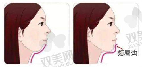 上海联合丽格整形收费不坑人，鼻综合5万起/眼修复1.5万起，明码标价无隐形消费