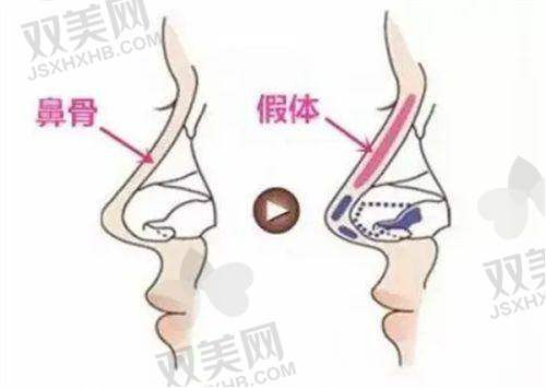 全文总结
