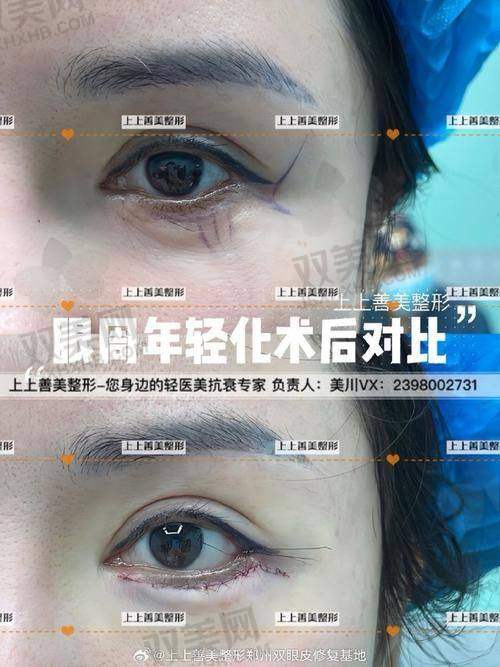 【珠海如花医疗美容门诊部技术特点】