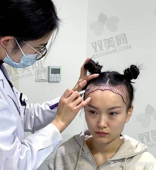 使用生发微针滚轮会伤害毛囊吗