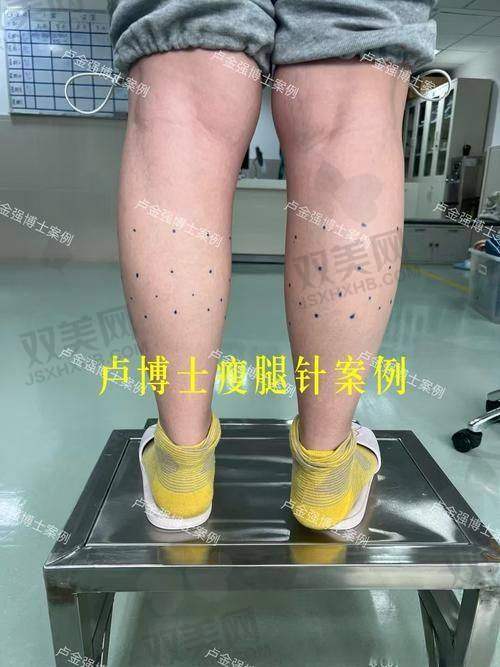 稀洛因馒化针市场乱象