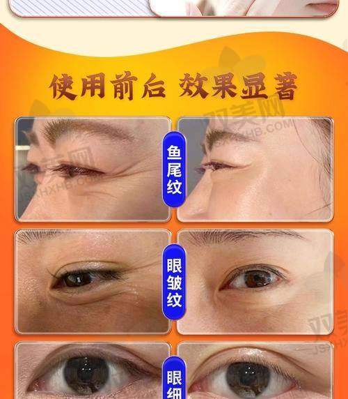 稀洛因馒化针是什么