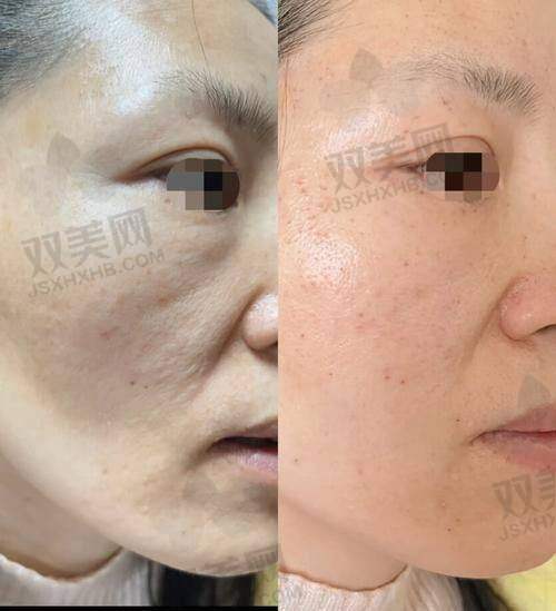 【西安英蓓仪医疗美容诊所电话号码是多少】