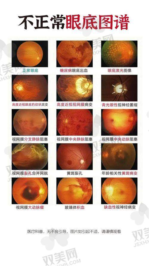 【石家庄联谊眼科医院营业时间是什么时候】