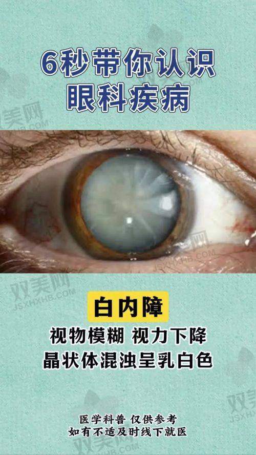 【石家庄联谊眼科医院是正规的吗】